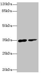 Western blot All lanes: RNF148 antibody at 6µg/ml Lane 1: Hela whole cell lysate Lane 2: HepG2 whole cell lysate Secondary Goat polyclonal to rabbit IgG at 1/10000 dilution Predicted band size: 35 kDa Observed band size: 35 kDa