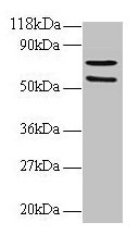 Western blot All lanes: SDHA antibody at 2µg/ml + 293T whole cell lysate Secondary Goat polyclonal to rabbit IgG at 1/15000 dilution Predicted band size: 73, 68, 57 kDa Observed band size: 73, 57 kDa