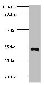 Western blot All lanes: RNF212 antibody at 14ug/ml + HepG2 whole cell lysate Secondary Goat polyclonal to rabbit IgG at 1/10000 dilution Predicted band size: 34, 15, 22, 32, 27, 31 kDa Observed band size: 34 kDa