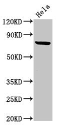 Western Blot Positive WB detected in: Hela whole cell lysate All lanes: RNF219 antibody at 4ug/ml Secondary Goat polyclonal to rabbit IgG at 1/50000 dilution Predicted band size: 81 kDa Observed band size: 81 kDa