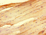 Immunohistochemistry of paraffin-embedded human skeletal muscle tissue using CSB-PA019889LA01HU at dilution of 1:100