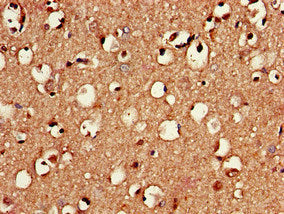 Immunohistochemistry of paraffin-embedded human brain tissue using CSB-PA019890LA01HU at dilution of 1:100