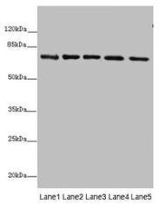 Western blot All lanes: SDHA antibody at 10µg/ml Lane 1: Rat heart tissue Lane 2: Mouse spleen tissue Lane 3: Mouse liver tissue Lane 4: Hela whole cell lysate Lane 5: Zebrafish lysate Secondary Goat polyclonal to rabbit IgG at 1/10000 dilution Pr...