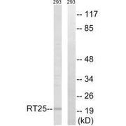 Western blot analysis of extracts from 293 cells, using MRPS25 antibody.