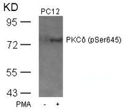 Western blot analysis of extracts from PC12 cells untreated or treated with PMA using PKCd(Phospho-Ser645) Antibody.
