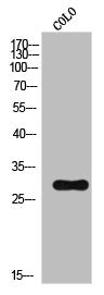 Western Blot analysis of COLO cells using ATF-1 Polyclonal Antibody