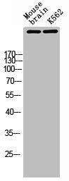 Western Blot analysis of MOUSE-BRAIN K562 cells using Atm Polyclonal Antibody