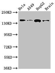 Western Blot Positive WB detected in: Hela whole cell lysate, A549 whole cell lysate, HepG2 whole cell lysate, Mouse brain tissue All lanes: ROCK2 antibody at 2.7ug/ml Secondary Goat polyclonal to rabbit IgG at 1/50000 dilution Predicted band size...