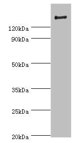 Western blot All lanes: ROCK2 antibody at 2ug/ml + Rat brain tissue Secondary Goat polyclonal to rabbit IgG at 1/10000 dilution Predicted band size: 161 kDa Observed band size: 161 kDa