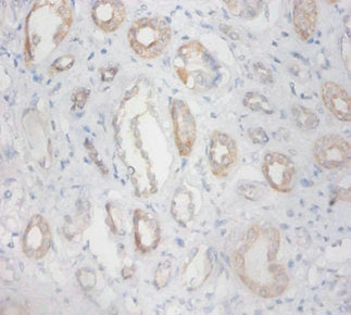 Immunohistochemistry of paraffin-embedded human kidney tissue using CSB-PA02005A0Rb at dilution of 1:100