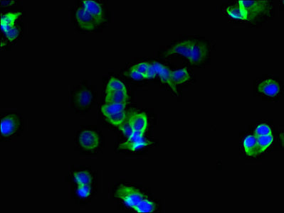 Immunofluorescent analysis of MCF-7 cells using CSB-PA020063LA01HU at dilution of 1:100 and Alexa Fluor 488-congugated AffiniPure Goat Anti-Rabbit IgG(H+L)