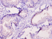 Immunohistochemistry of paraffin-embedded human prostate tissue using CSB-PA020067LA01HU at dilution of 1:10