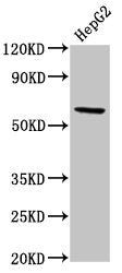 Western Blot Positive WB detected in: HepG2 whole cell lysate All lanes: RORC antibody at 5.2µg/ml Secondary Goat polyclonal to rabbit IgG at 1/50000 dilution Predicted band size: 59, 56 kDa Observed band size: 59 kDa