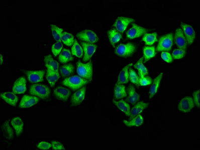 Immunofluorescence staining of Hela cells with CSB-PA020072LA01HU at 1:133, counter-stained with DAPI. The cells were fixed in 4% formaldehyde, permeabilized using 0.2% Triton X-100 and blocked in 10% normal Goat Serum. The cells were then incubat...
