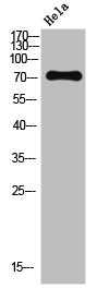 Western blot analysis of HELA using p-NF2 (S518) antibody.