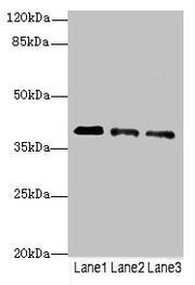 Western blot All lanes: RP2antibody at 3.81ug/ml Lane 1: Jurkat whole cell lysate Lane 2: HepG2 whole cell lysate Lane 3: Hela whole cell lysate Secondary Goat polyclonal to rabbit IgG at 1/10000 dilution Predicted band size: 40 kDa Observed band...
