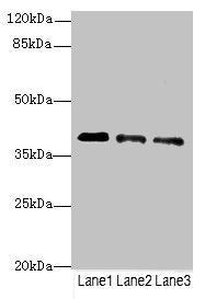 Western blot All lanes: RP2antibody at 3.81ug/ml Lane 1: Jurkat whole cell lysate Lane 2: HepG2 whole cell lysate Lane 3: Hela whole cell lysate Secondary Goat polyclonal to rabbit IgG at 1/10000 dilution Predicted band size: 40 kDa Observed band...