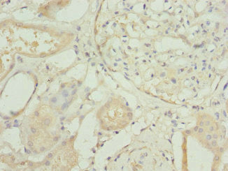 Immunohistochemistry of paraffin-embedded human kidney tissue using CSB-PA020076ESR2HU at dilution of 1:100