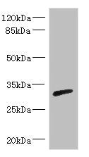 Western blot All lanes: RPIA antibody IgG at 3.29ug/ml + Mouse kidney tissue Secondary Goat polyclonal to rabbit IgG at 1/10000 dilution Predicted band size: 33 kDa Observed band size: 33 kDa