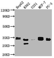 Western Blot Positive WB detected in: HepG2 whole cell lysate, K562 whole cell lysate, U251 whole cell lysate, MCF-7 whole cell lysate, PC-3 whole cell lysate All lanes: RPIA antibody at 1:2000 Secondary Goat polyclonal to rabbit IgG at 1/50000 di...