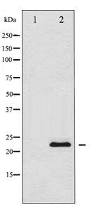 Western blot analysis of TIMP1 expression in 293 whole cell lysates, The lane on the left is treated with the antigen-specific peptide.