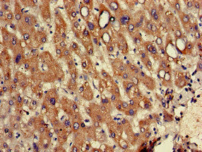 Immunohistochemistry of paraffin-embedded human liver tissue using CSB-PA020116LA01HU at dilution of 1:100