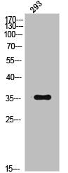 Western Blot analysis of 293 cells using Phospho-IκB-β (T19) Polyclonal Antibody