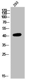 Western Blot analysis of 293 cells using NMBR Polyclonal Antibody
