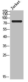 Western Blot analysis of Jurkat cells using Cleaved-Notch 2 (A1734) Polyclonal Antibody