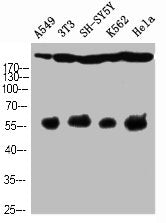 Western Blot analysis of A549 NIH-3T3 SH-SY5Y K562 HELA cells using Cleaved-Notch 4 (V1432) Polyclonal Antibody