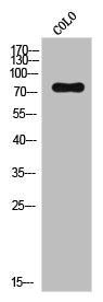 Western Blot analysis of CoLo cells using NSF Polyclonal Antibody