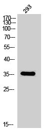 Western Blot analysis of 293 cells using Phospho-DOR-1 (S363) Polyclonal Antibody