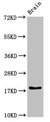 Western Blot Positive WB detected in: Rat brain tissue All lanes: RPL23A antibody at 3ug/ml Secondary Goat polyclonal to rabbit IgG at 1/50000 dilution Predicted band size: 18 kDa Observed band size: 18 kDa