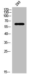 Western Blot analysis of 293 cells using Phospho-PAKα (T212) Polyclonal Antibody