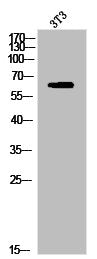 Western Blot analysis of 3T3 cells using Phospho-PAKα (S204) Polyclonal Antibody