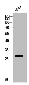 Western Blot analysis of A549 cells using IL-20 Polyclonal Antibody