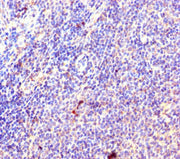 Immunohistochemistry of paraffin-embedded human lymphoid tissue using CSB-PA020248LA01HU at dilution of 1:100