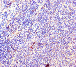 Immunohistochemistry of paraffin-embedded human lymphoid tissue using CSB-PA020248LA01HU at dilution of 1:100