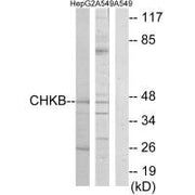 Western blot analysis of extracts from HepG2 cells and A549 cells, using CHKB antibody.