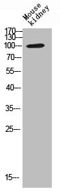 Western blot analysis of Mouse-kidney lysis using TNNI3K antibody.