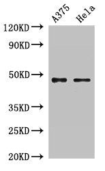 Western Blot Positive WB detected in: A375 whole cell lysate, Hela whole cell lysate All lanes: RPL4 antibody at 2µg/ml Secondary Goat polyclonal to rabbit IgG at 1/50000 dilution Predicted band size: 48 kDa Observed band size: 48 kDa