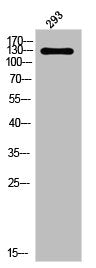 Western Blot analysis of 293 cells using Phospho-PDGFR-α (Y849) Polyclonal Antibody