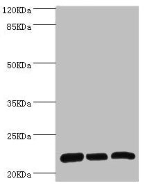 Western blot All lanes: RPL9 antibody at 0.61µg/ml Lane 1: SY-5Y whole cell lysate Lane 2: Hela whole cell lysate Lane 3: HepG2 whole cell lysate Secondary Goat polyclonal to rabbit IgG at 1/10000 dilution Predicted band size: 22 kDa Observed band...