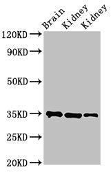 Western Blot Positive WB detected in: Rat brain tissue, Rat kidney tissue, Mouse kidney tissue All lanes: RPLP0 antibody at 3.4µg/ml Secondary Goat polyclonal to rabbit IgG at 1/50000 dilution Predicted band size: 35, 28 kDa Observed band size: 35...