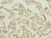 Immunohistochemistry of paraffin-embedded human lung tissue using CSB-PA020342DSR1HU at dilution of 1:100