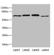 Western blot All lanes: RPN2 antibody at 1.91µg/ml Lane 1: NIH/3T3 whole cell lysate Lane 2: 293T whole cell lysate Lane 3: Hela whole cell lysate Lane 4: Human placenta tissue Secondary Goat polyclonal to rabbit IgG at 1/10000 dilution Predicted...