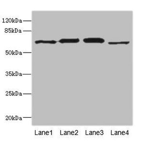 Western blot All lanes: RPN2 antibody at 1.91µg/ml Lane 1: NIH/3T3 whole cell lysate Lane 2: 293T whole cell lysate Lane 3: Hela whole cell lysate Lane 4: Human placenta tissue Secondary Goat polyclonal to rabbit IgG at 1/10000 dilution Predicted...
