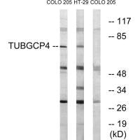 Western blot analysis of extracts from COLO cells and HT-29 cells, using TUBGCP4 antibody.