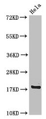 Western Blot Positive WB detected in: Hela whole cell lysate All lanes: RPS15 antibody at 4µg/ml Secondary Goat polyclonal to rabbit IgG at 1/50000 dilution Predicted band size: 18 kDa Observed band size: 18 kDa
