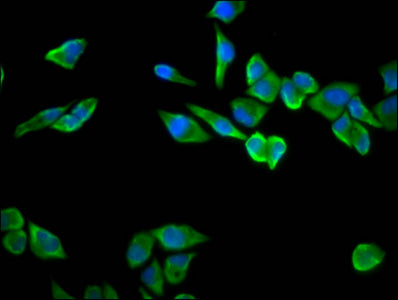Immunofluorescence staining of Hela cells with CSB-PA020400LA01HU at 1:100, counter-stained with DAPI. The cells were fixed in 4% formaldehyde, permeabilized using 0.2% Triton X-100 and blocked in 10% normal Goat Serum. The cells were then incubat...